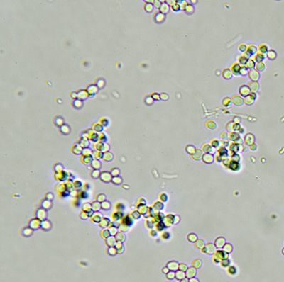 Yeast cells